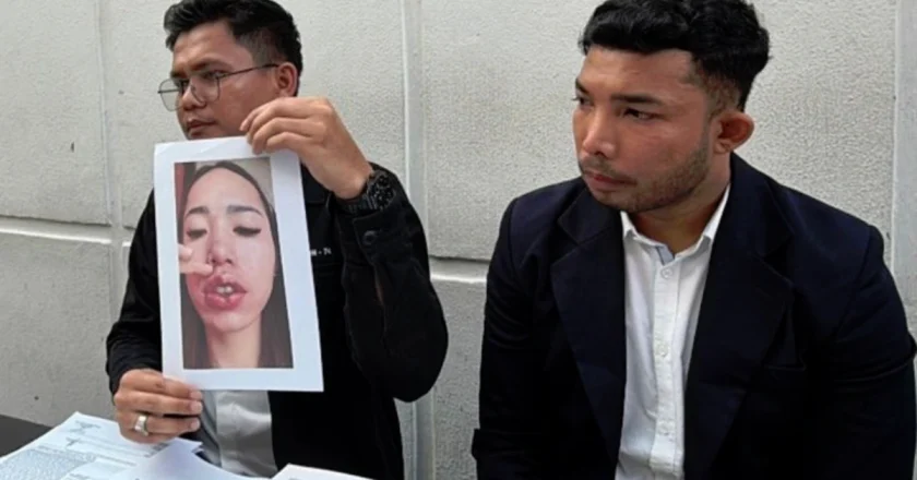 Klinik Kecantikan Riau Malpraktik, Putri Indonesia Jeni Rahmadial Fitri Jadi Tersangka